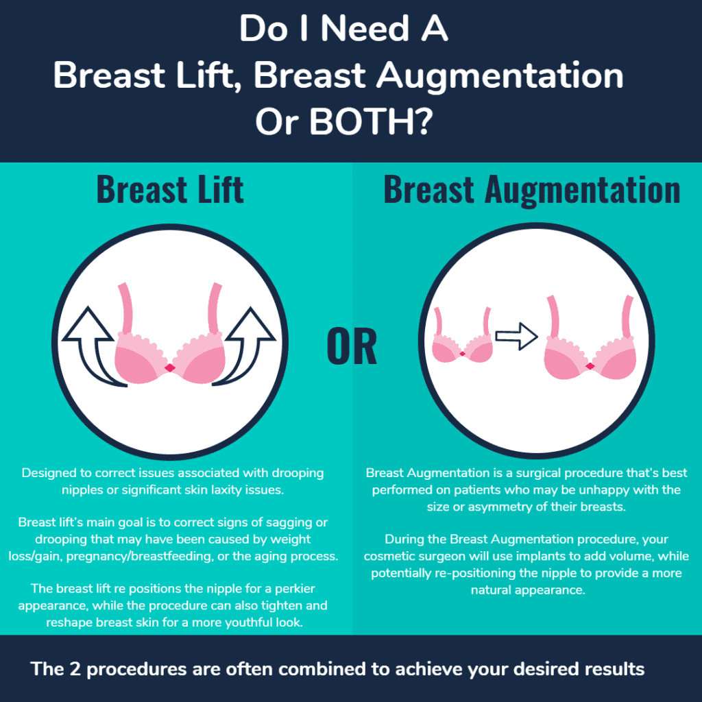 Do I Need a Breast Lift, a Breast Augmentation, or Both